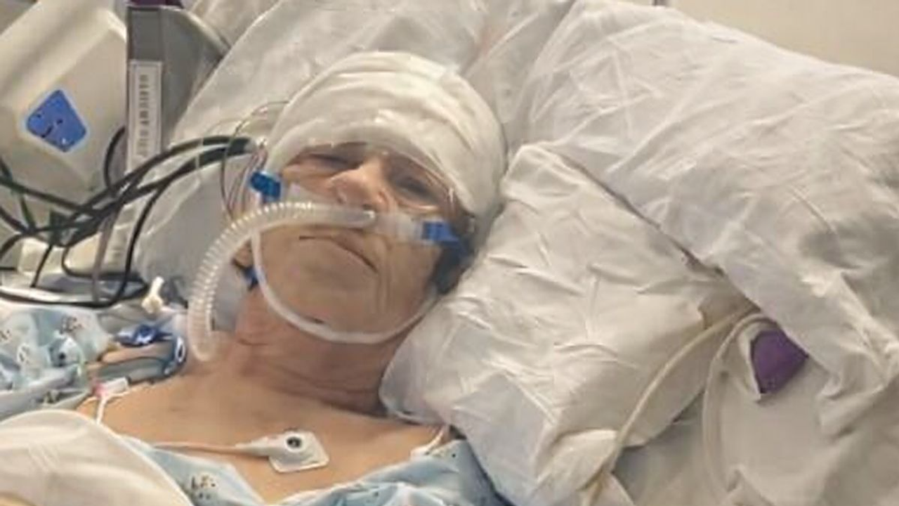 Brasileira de 69 anos sofre AVC ao volante, bate carro em árvore e luta pela vida na UTI em Marietta