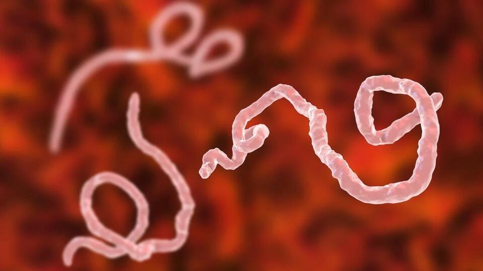 EUA anunciam restrições temporárias e reforçam controle em aeroportos após emergência internacional por ebola