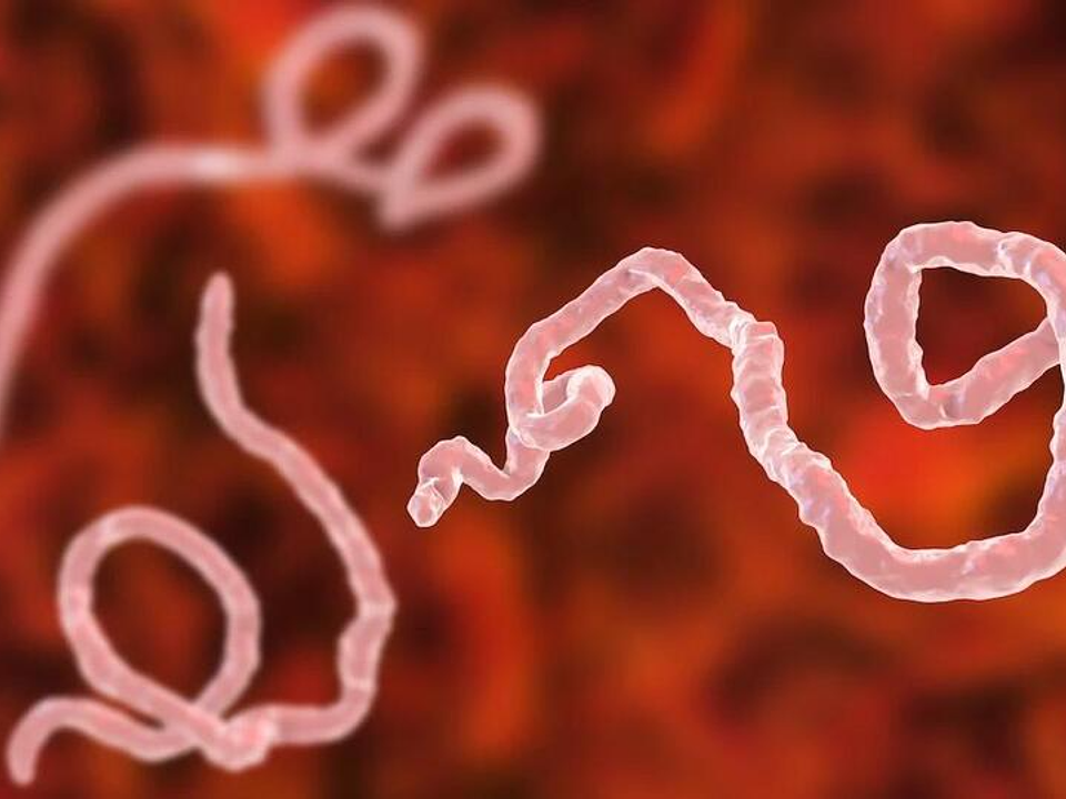EUA anunciam restrições temporárias e reforçam controle em aeroportos após emergência internacional por ebola