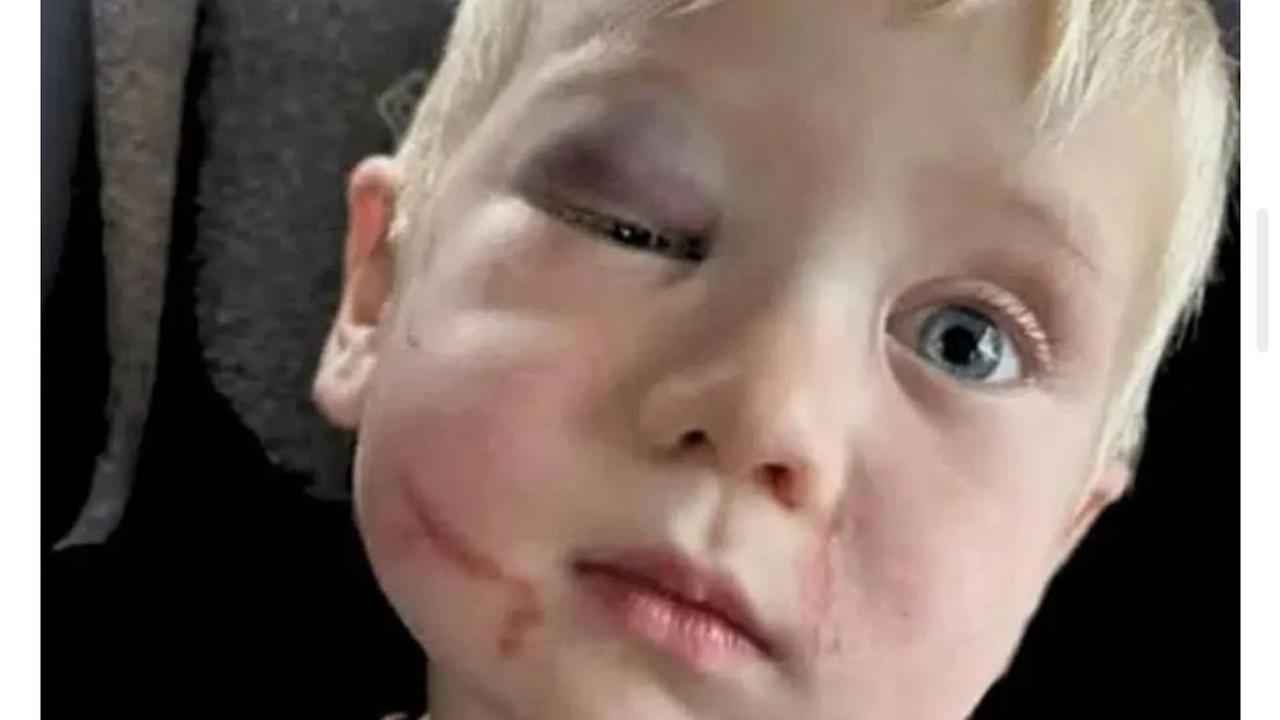 Funcionária de creche presa por agredir bebê na Geórgia